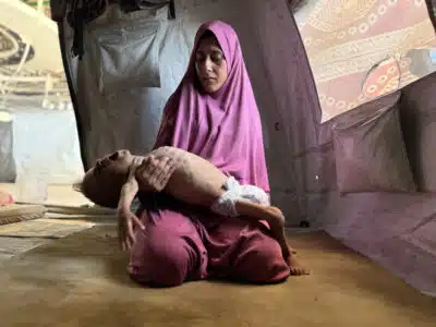 FOTODELDIA JERUSALÉN, 26/07/2025.- El pequeño gazatí Mohamed Motawaq, de tan solo 18 meses, de cuerpo esquelético pasa los días en Gaza en brazos de su madre, Hidaya al Mutauaq, un mujer viuda, de 30 años, sin apenas leche y otros productos básicos por las restricciones que Israel. La desnutrición mató a otras cinco personas, incluido un bebe, en las últimas 24 horas en Gaza, informó el hospital Al Shifa de la franja palestina. EFE/ Ahmad Awad