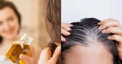 Milagre em gotas: Óleo escurece cabelo branco natural! Milagre em gotas: Óleo escurece cabelo branco natural!