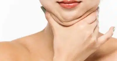 Pescoço Definido: Dicas Naturais para Eliminar a Papada e Conquistar o Queixo Ideal