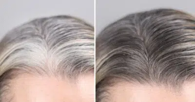 Cabelos Brancos? Descubra 4 Óleos Naturais para um Toque Dourado!