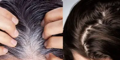 Cabelos Brancos? Receita Caseira Revelada: Creme com Café Neutraliza em Casa