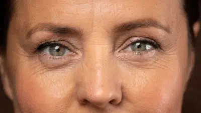 Óleo de Rosa Mosqueta: Segredo Natural para Pele Radiante e Livre de Rugas