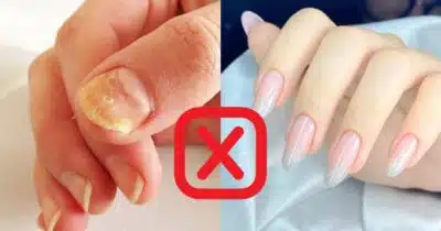 Unhas Fracas e Amareladas? Truque Caseiro com Limão e Azeite Restaura Brilho e Fortalece!