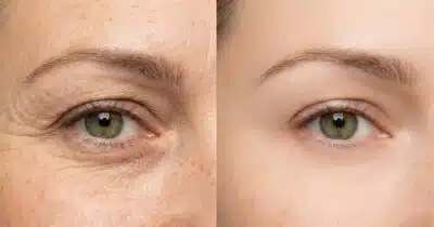 Produtos Vichy: Rotina Anti-Idade Revela Segredos para Pele Radiante e Livre de Rugas em 2025