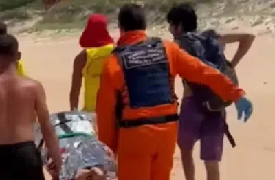 Psicóloga Atacada por Capivara em Praia de Florianópolis: Recuperação e Revelações!