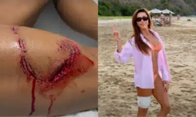 Turista em Fernando de Noronha Sofre Mordida de Tubarão – Detalhes Surreais!