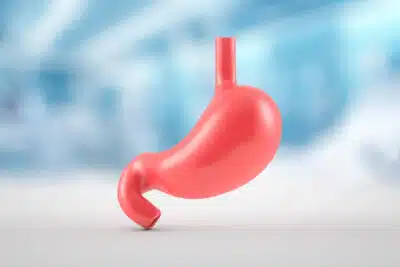 Ácido do Estômago em Desequilíbrio: Hipocloridria e Hiperacidez – O Que Saber!